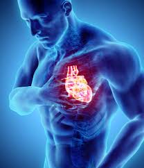 heart attack image.jpg